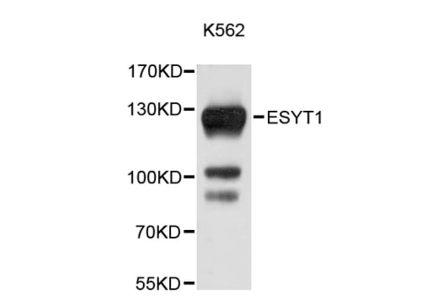 Western Blot - Anti-ESYT1 Antibody (A9465) - Antibodies.com