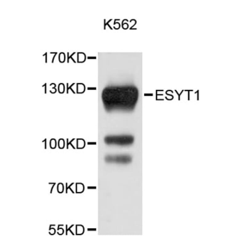 Western Blot - Anti-ESYT1 Antibody (A9465) - Antibodies.com