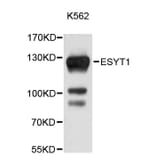 Western Blot - Anti-ESYT1 Antibody (A9465) - Antibodies.com