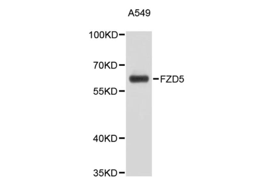 Western Blot - Anti-FZD5 Antibody (A9469) - Antibodies.com