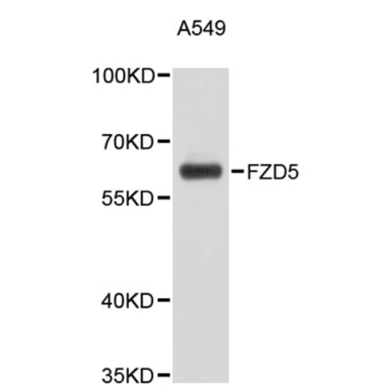 Western Blot - Anti-FZD5 Antibody (A9469) - Antibodies.com