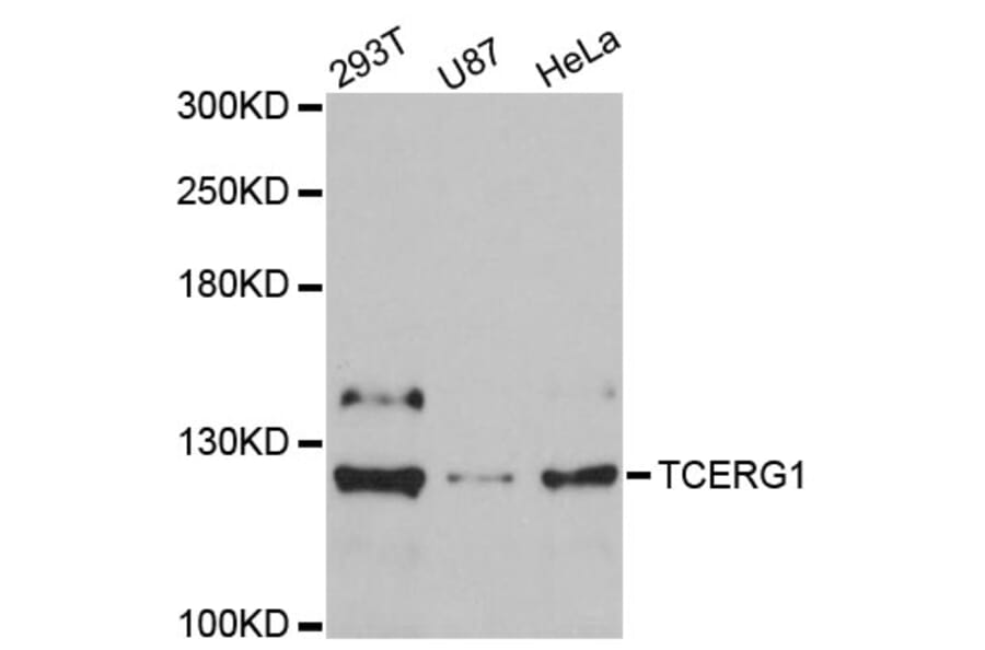 Western Blot - Anti-TCERG1 Antibody (A9479) - Antibodies.com
