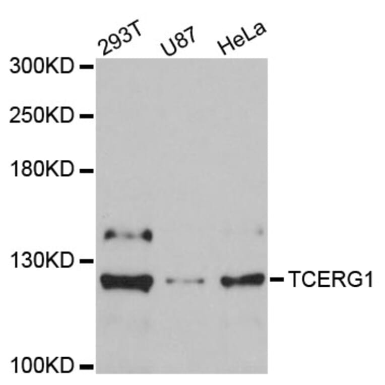 Western Blot - Anti-TCERG1 Antibody (A9479) - Antibodies.com