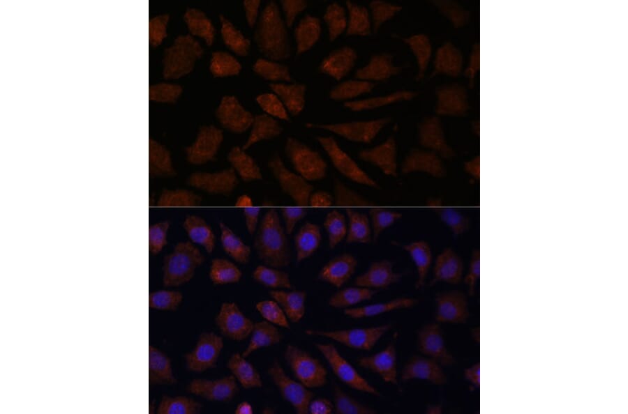 Immunofluorescence - Anti-OAS3 Antibody (A10720) - Antibodies.com