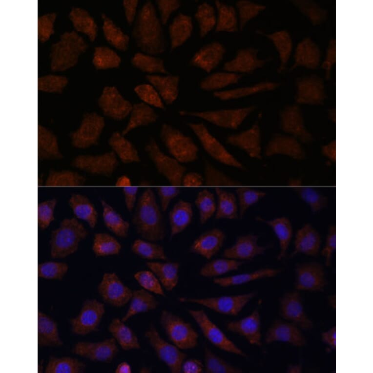 Immunofluorescence - Anti-OAS3 Antibody (A10720) - Antibodies.com