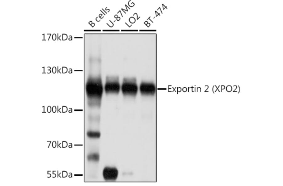 Western Blot - Anti-Cellular Apoptosis Susceptibility/CSE1L Antibody (A10726) - Antibodies.com