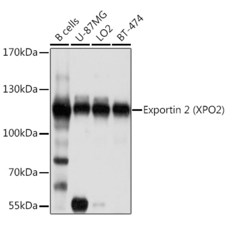 Western Blot - Anti-Cellular Apoptosis Susceptibility/CSE1L Antibody (A10726) - Antibodies.com