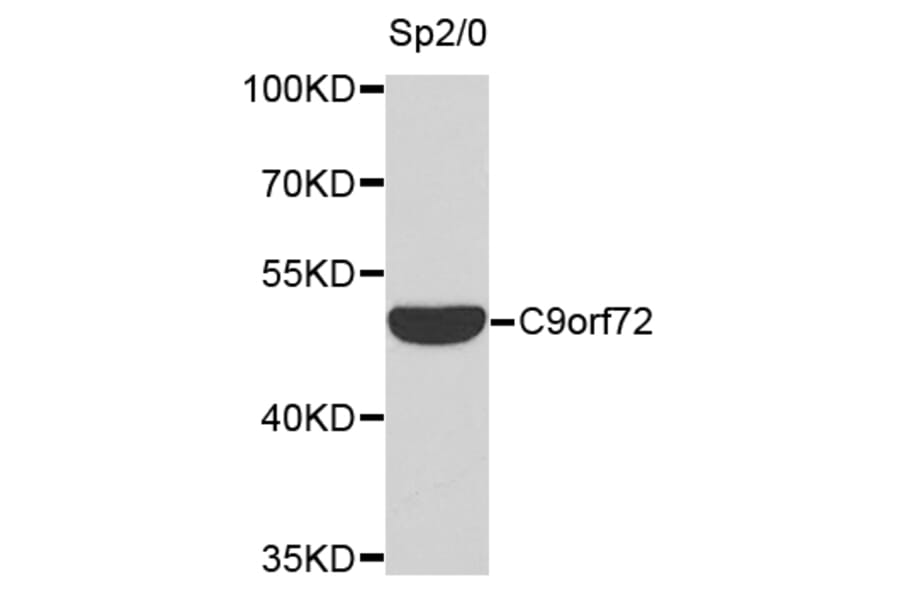 Western Blot - Anti-C9orf72 Antibody (A9532) - Antibodies.com