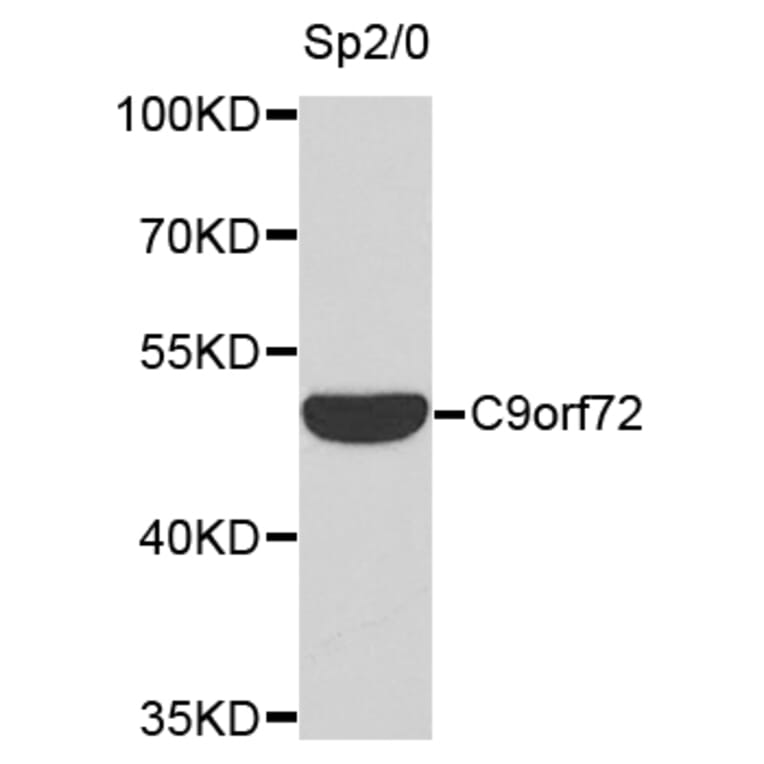 Western Blot - Anti-C9orf72 Antibody (A9532) - Antibodies.com