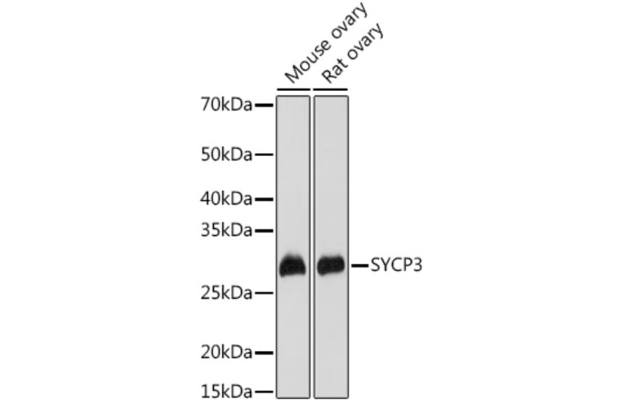 Western Blot - Anti-SCP3 Antibody (A10729) - Antibodies.com