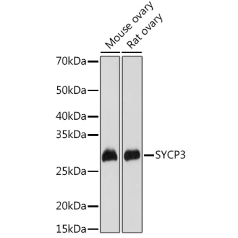 Western Blot - Anti-SCP3 Antibody (A10729) - Antibodies.com