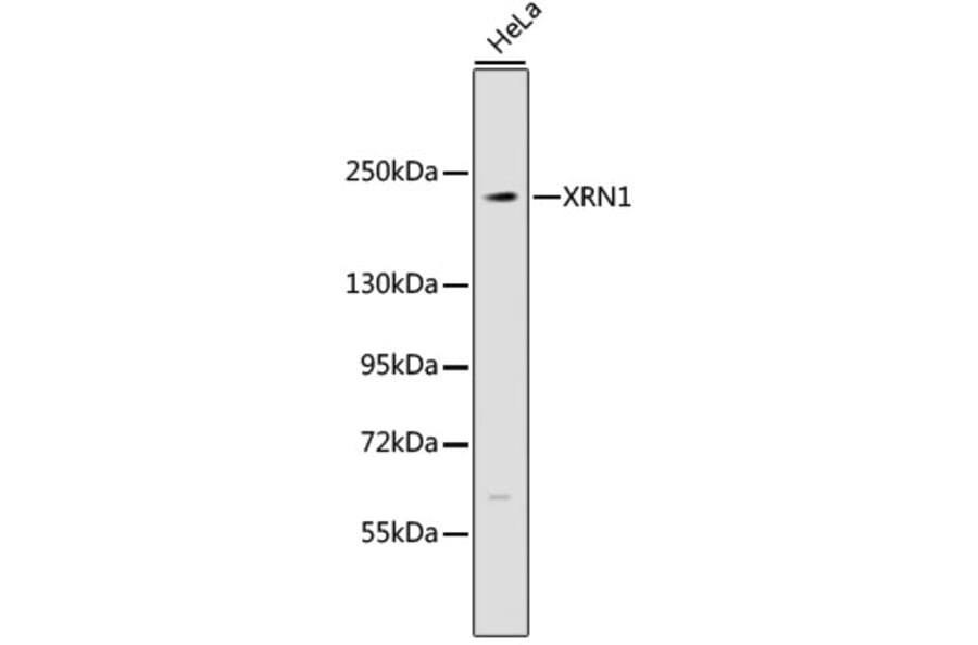 Western Blot - Anti-XRN1 Antibody (A9554) - Antibodies.com
