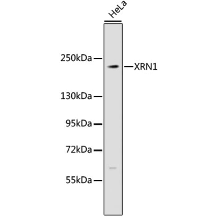 Western Blot - Anti-XRN1 Antibody (A9554) - Antibodies.com