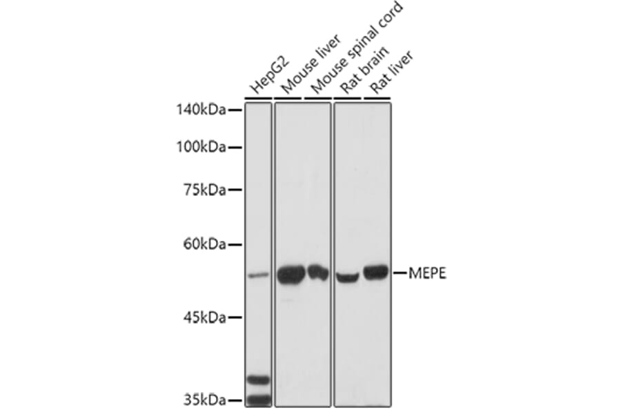 Western Blot - Anti-MEPEELISAKit Antibody (A10733) - Antibodies.com