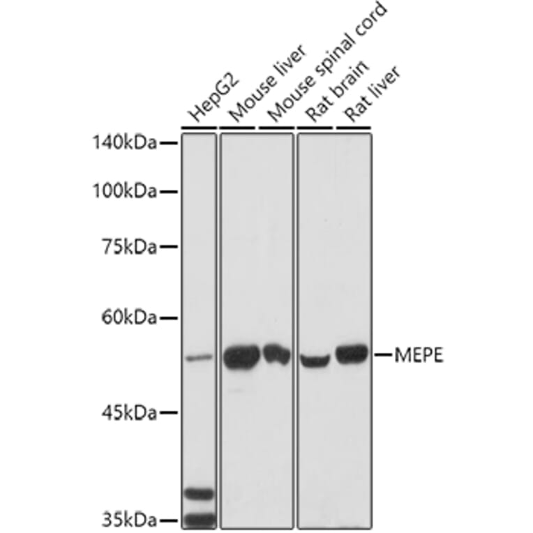 Western Blot - Anti-MEPEELISAKit Antibody (A10733) - Antibodies.com