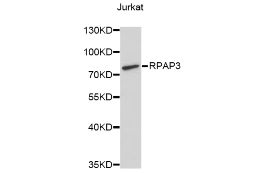 Western Blot - Anti-RPAP3 Antibody (A9575) - Antibodies.com