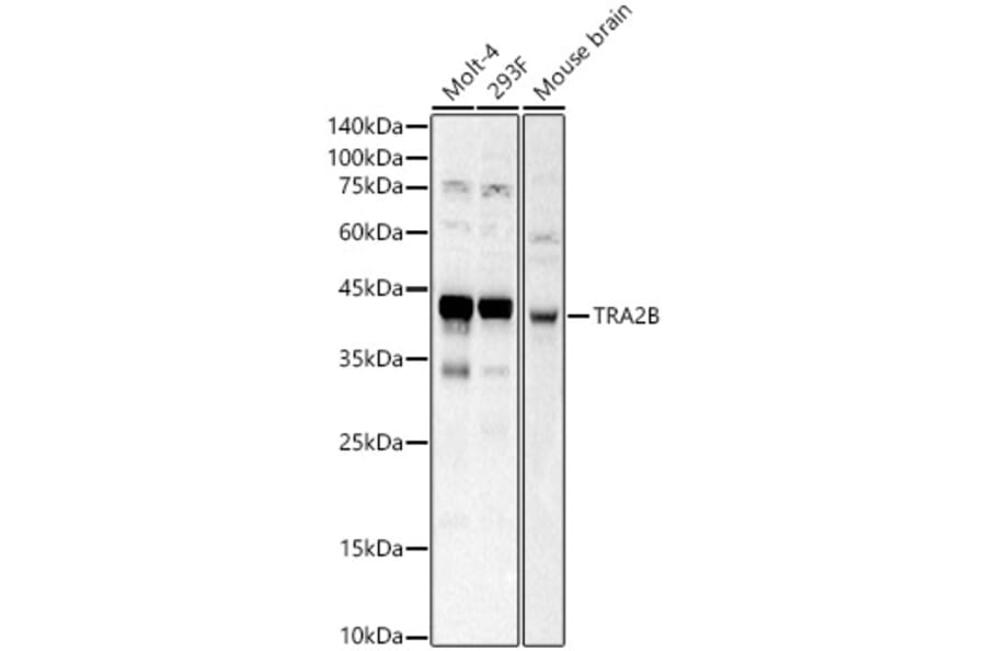 Western Blot - Anti-TRA2B/SFRS10 Antibody (A10738) - Antibodies.com