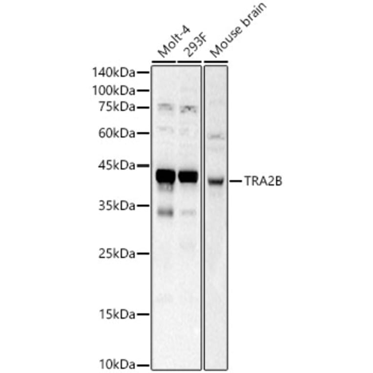 Western Blot - Anti-TRA2B/SFRS10 Antibody (A10738) - Antibodies.com
