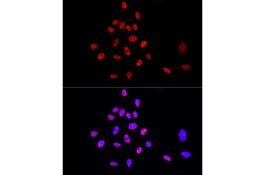 Immunofluorescence - Anti-TRA2B/SFRS10 Antibody (A10738) - Antibodies.com