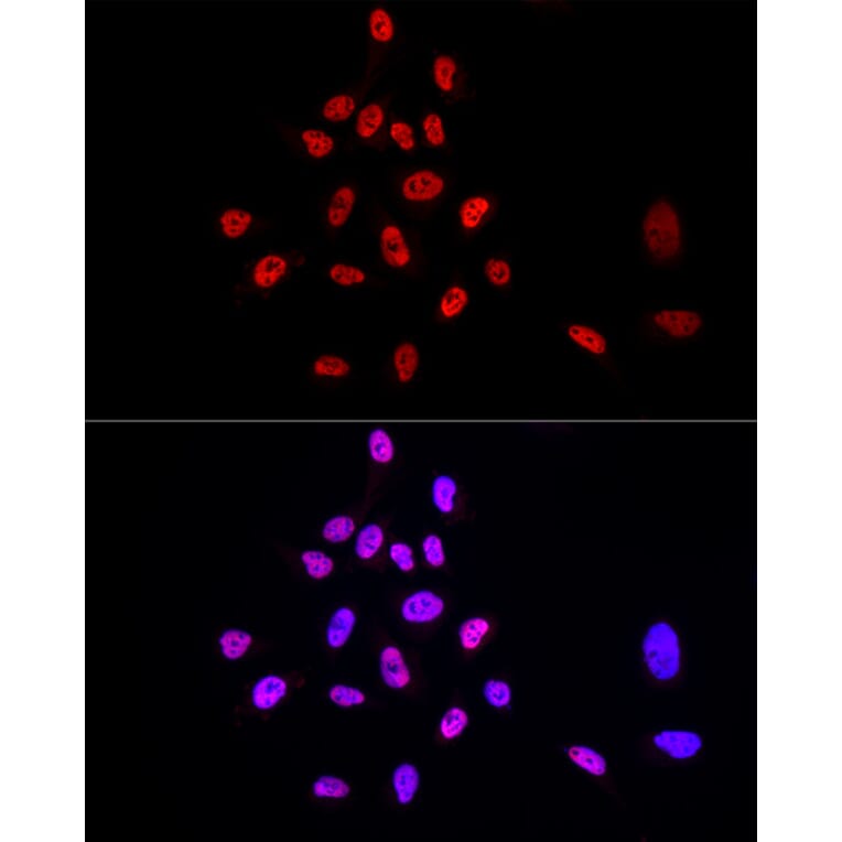 Immunofluorescence - Anti-TRA2B/SFRS10 Antibody (A10738) - Antibodies.com