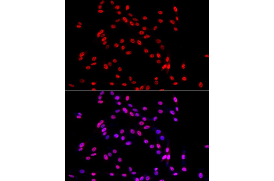 Immunofluorescence - Anti-TRA2B/SFRS10 Antibody (A10738) - Antibodies.com