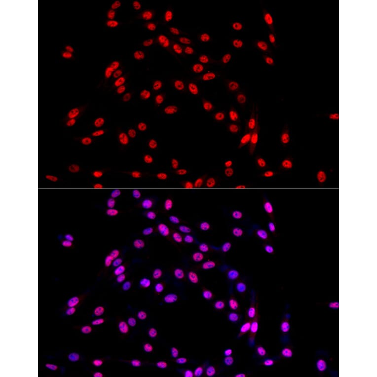 Immunofluorescence - Anti-TRA2B/SFRS10 Antibody (A10738) - Antibodies.com