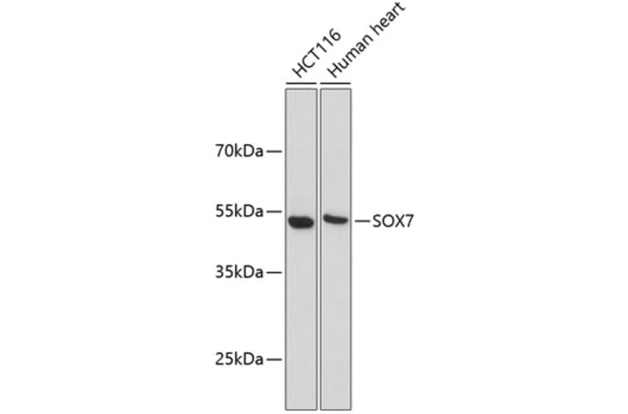 Western Blot - Anti-SOX7 Antibody (A9587) - Antibodies.com
