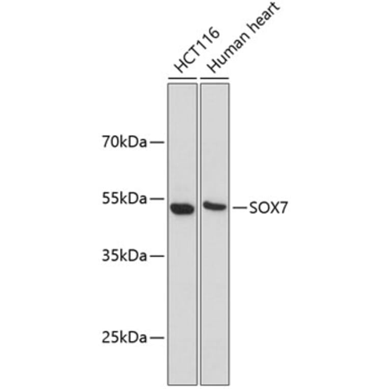 Western Blot - Anti-SOX7 Antibody (A9587) - Antibodies.com
