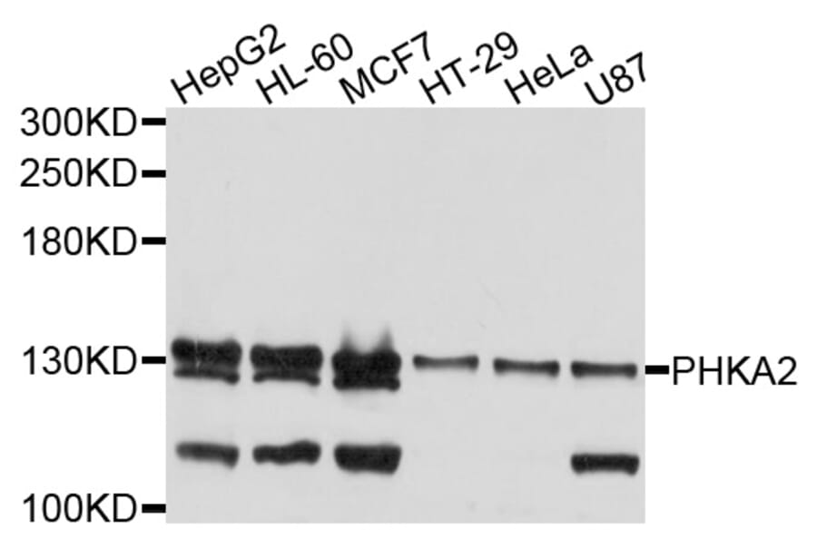 Western Blot - Anti-PHKA2 Antibody (A9636) - Antibodies.com