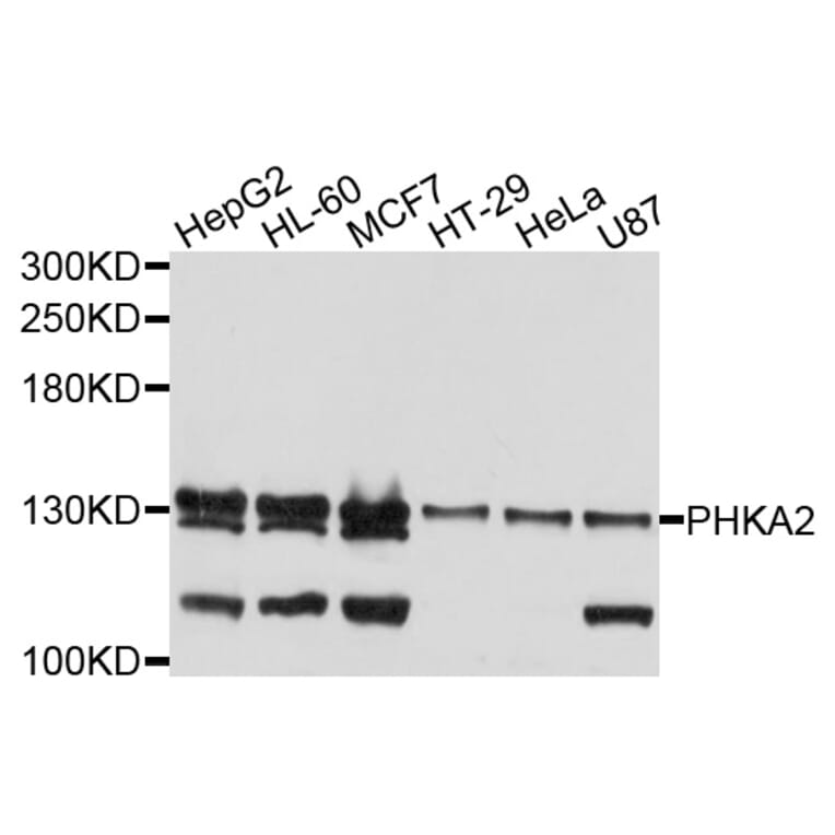 Western Blot - Anti-PHKA2 Antibody (A9636) - Antibodies.com