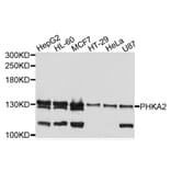 Western Blot - Anti-PHKA2 Antibody (A9636) - Antibodies.com