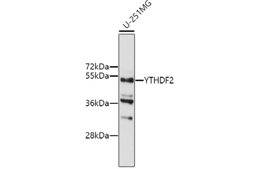 Western Blot - Anti-YTHDF2 Antibody (A9639) - Antibodies.com