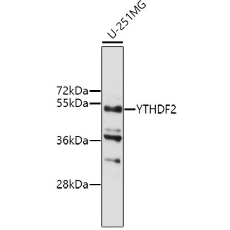 Western Blot - Anti-YTHDF2 Antibody (A9639) - Antibodies.com
