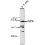 Western Blot - Anti-YTHDF2 Antibody (A9639) - Antibodies.com