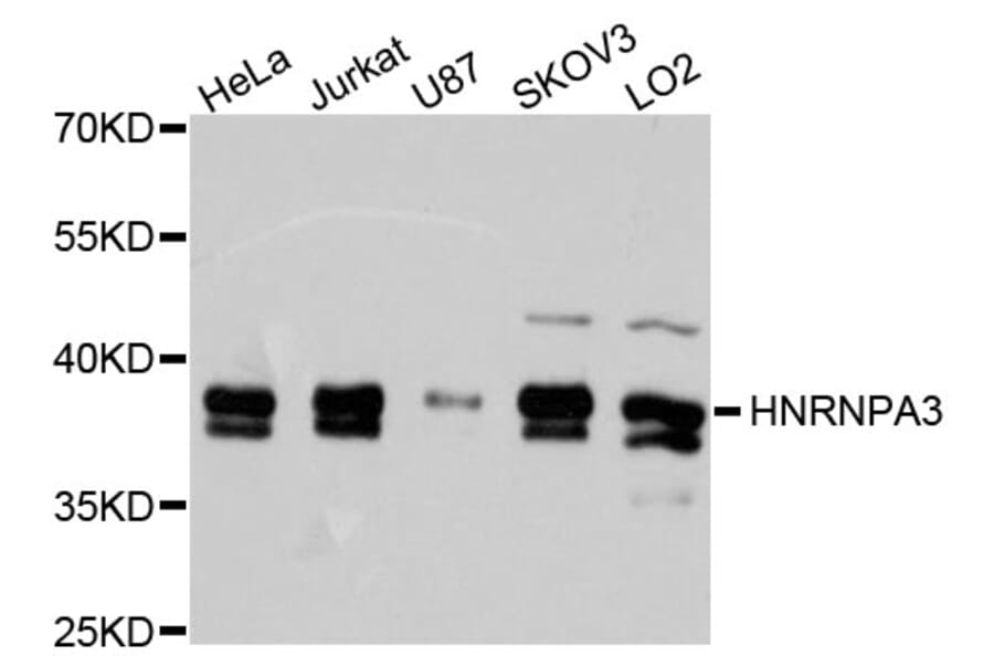 Western Blot - Anti-HNRNPA3 Antibody (A9669) - Antibodies.com