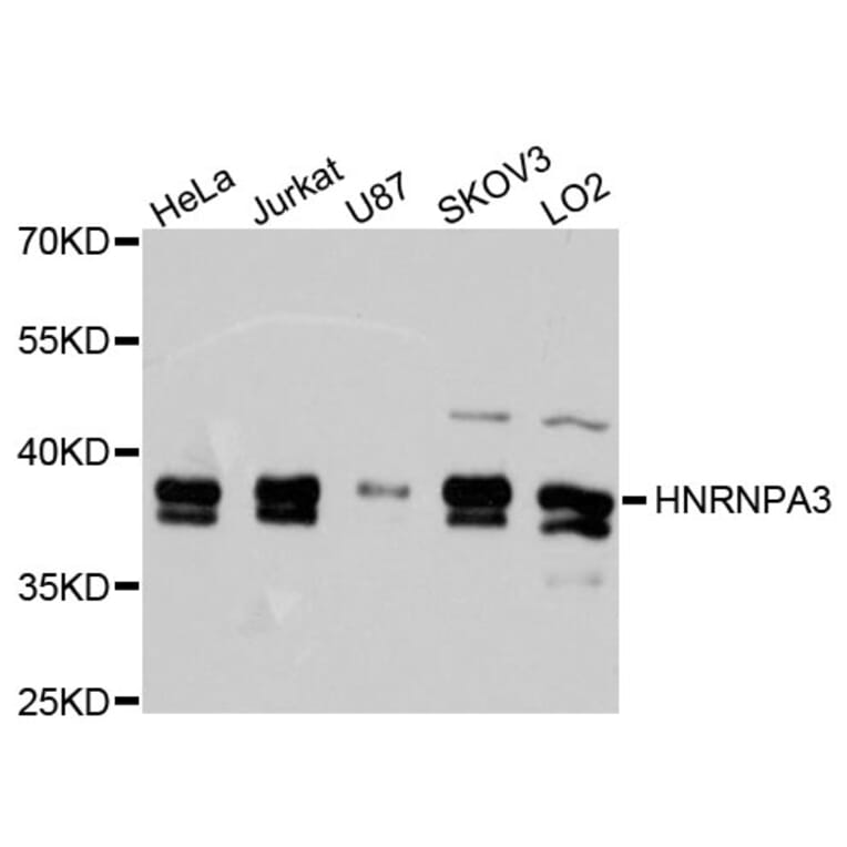 Western Blot - Anti-HNRNPA3 Antibody (A9669) - Antibodies.com