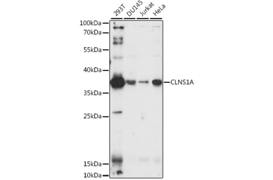 Western Blot - Anti-CLNS1A/CLCI Antibody (A10781) - Antibodies.com