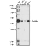 Western Blot - Anti-CLNS1A/CLCI Antibody (A10781) - Antibodies.com