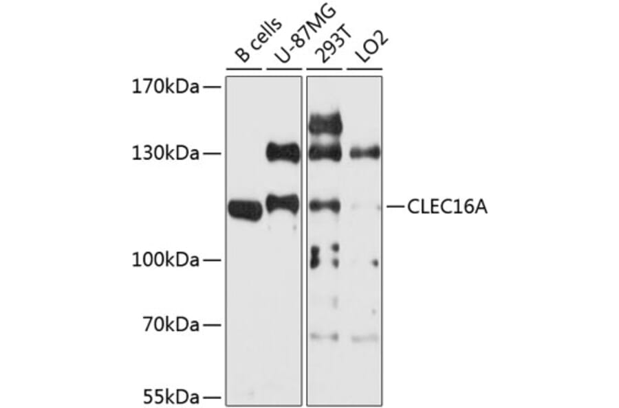 Western Blot - Anti-CLEC16A Antibody (A9753) - Antibodies.com