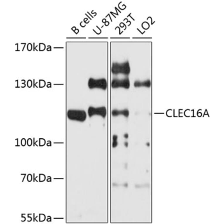Western Blot - Anti-CLEC16A Antibody (A9753) - Antibodies.com