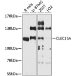 Western Blot - Anti-CLEC16A Antibody (A9753) - Antibodies.com