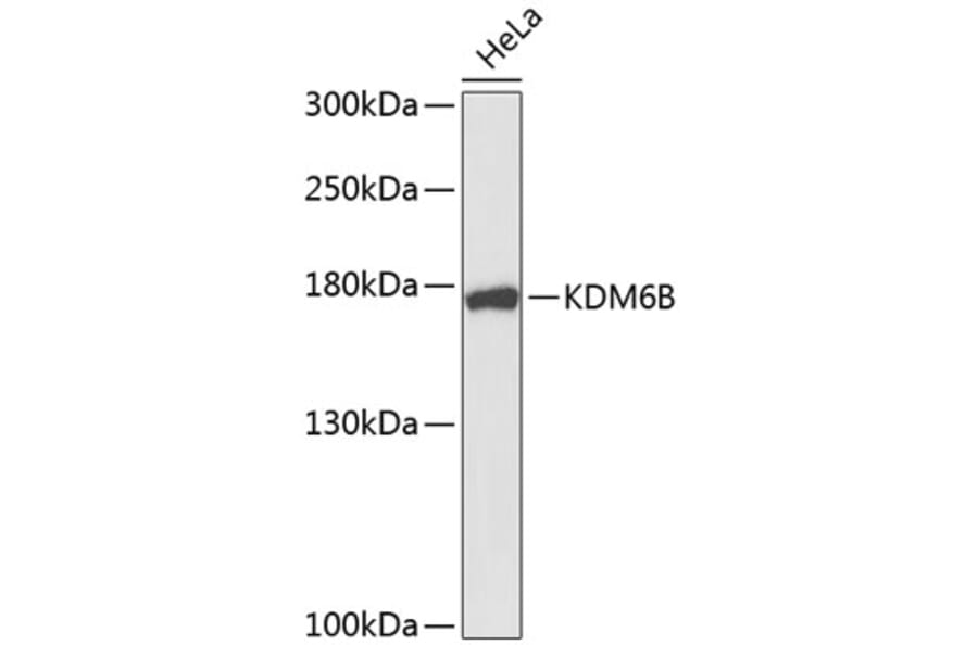 Western Blot - Anti-JMJD3 Antibody (A9780) - Antibodies.com