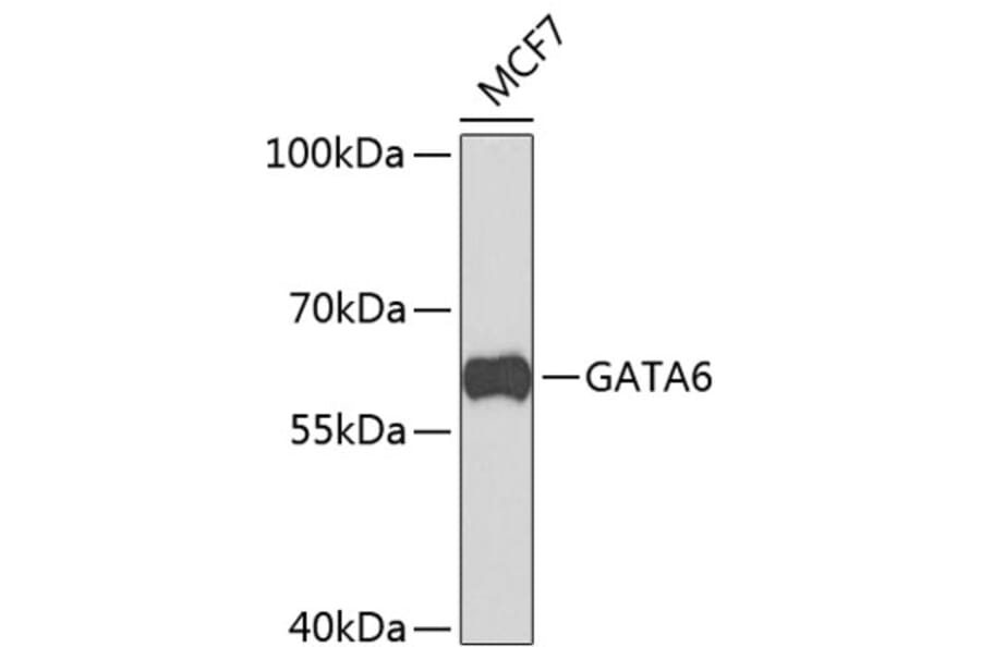 Western Blot - Anti-GATA6 Antibody (A9786) - Antibodies.com