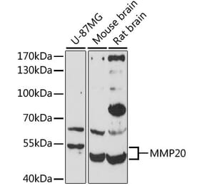 Western Blot - Anti-MMP20 Antibody (A10798) - Antibodies.com