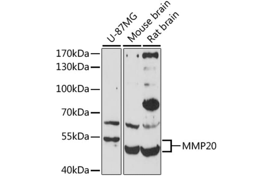 Western Blot - Anti-MMP20 Antibody (A10798) - Antibodies.com
