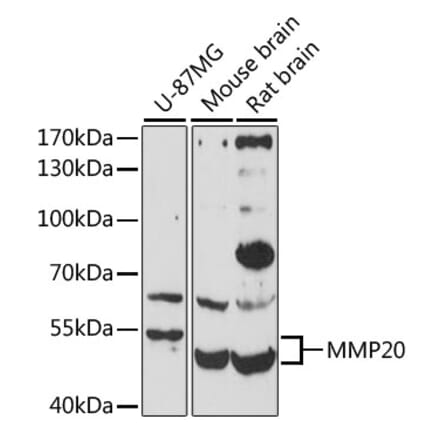 Western Blot - Anti-MMP20 Antibody (A10798) - Antibodies.com