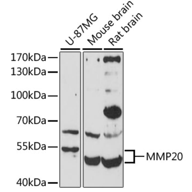 Western Blot - Anti-MMP20 Antibody (A10798) - Antibodies.com