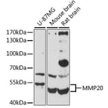 Western Blot - Anti-MMP20 Antibody (A10798) - Antibodies.com