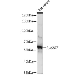 Western Blot - Anti-PLA2G7 Antibody (A10799) - Antibodies.com