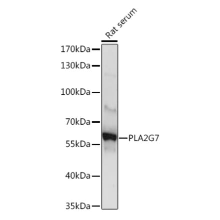 Western Blot - Anti-PLA2G7 Antibody (A10799) - Antibodies.com